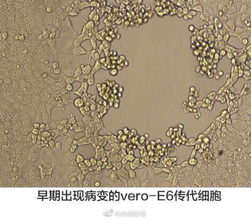 科學家持續開發疫苗。（圖／翻攝自微博）