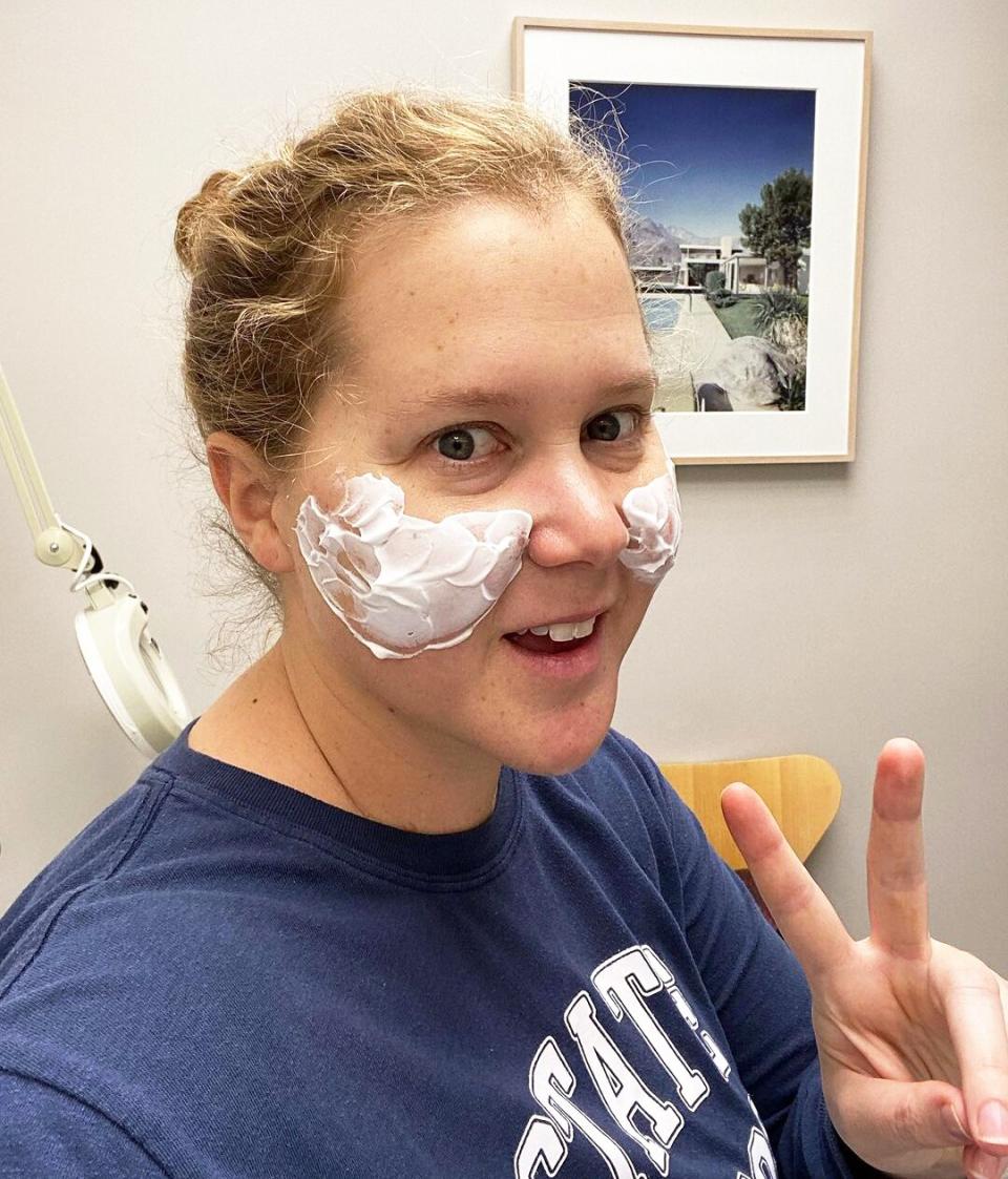 Amy Schumer 'Tried Getting Fillers' Before Having Them Dissolved: 'I Was Already Full'