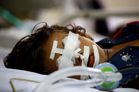 A child is seen in the ontensive care unit in the Baba Raghav Das hospital in Gorakhpur district, India August 13, 2017. REUTERS/Cathal McNaughton