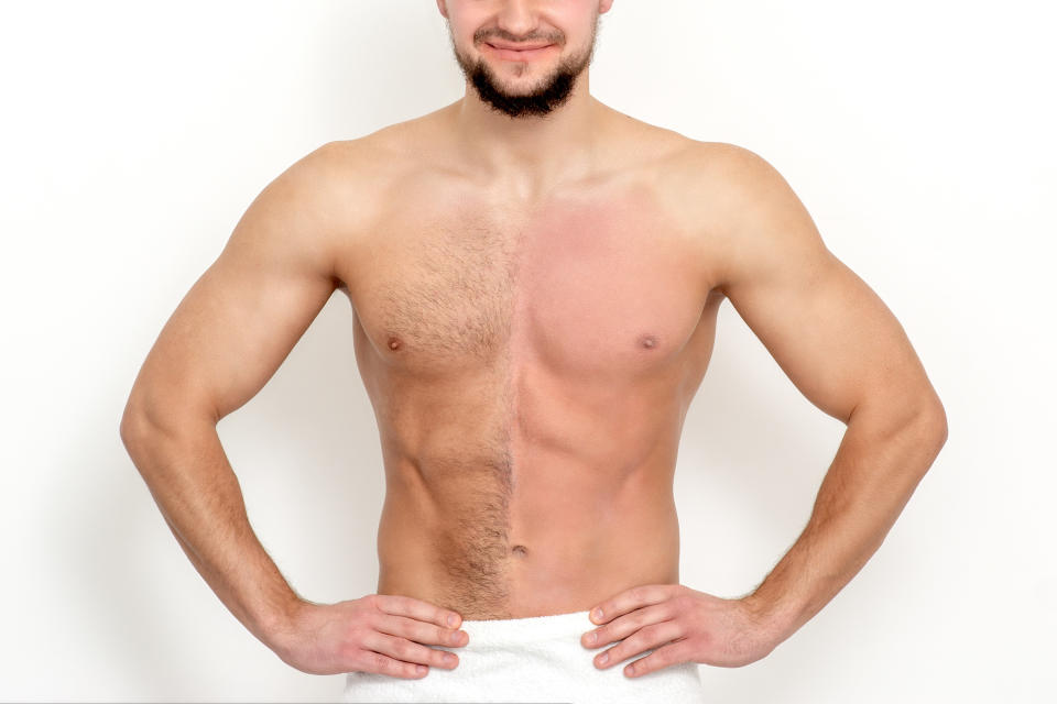 Young caucasian man with bare chested before and after waxing his hair stands on white background