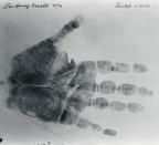 <p>Lee Harvey Oswald palm print taken on Nov. 22, 1963, the day President Kennedy was assassinated and the day Oswald, the alleged assassin, was arrested. The circled portion shows the print fragment that was on the cardboard box in the Texas School Book Depository, the site the assassin’s bullets were fired from according to the Warren Commission. Oswald was shot by Jack Ruby two days after this print was taken. (Photo: Corbis via Getty Images) </p>