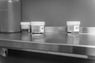 <p>Urine samples on shelf at Groups in Middletown, Ohio. Here, patients are trusted to produce their samples without supervision. (Photograph by Mary F. Calvert for Yahoo News) </p>