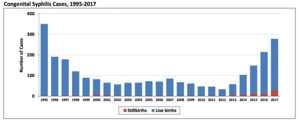 Congenital syphilis cases spiked sharply in CA