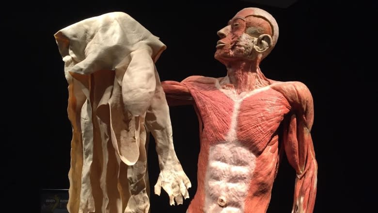 Calgary 1st city in Canada and U.S. to exhibit Body Worlds 'coupling' specimen