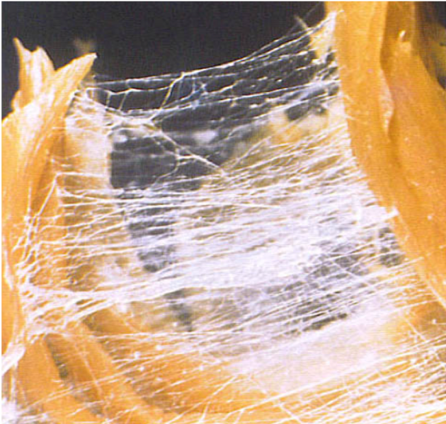 An image of fascia in the shoulder