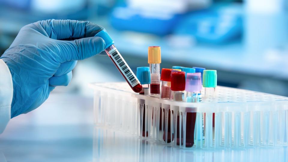 Technician's gloved hand taking a blood sample tube from a rack in a research laboratory