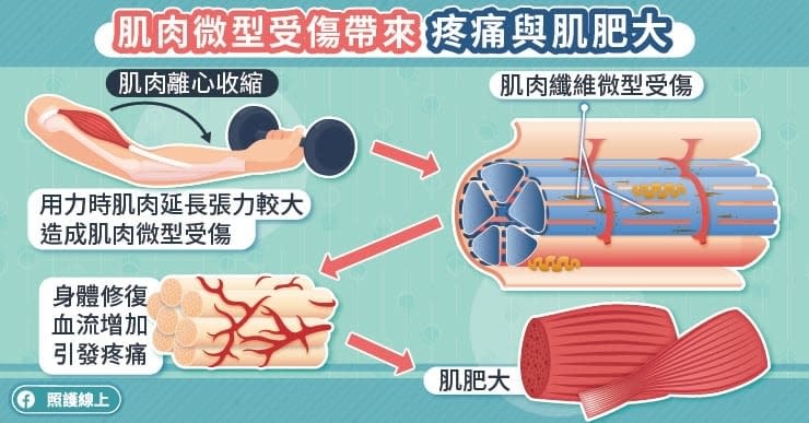 延遲性肌肉痠痛起源