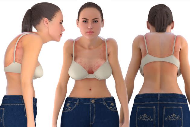 This Is What Wearing The Wrong Bra Size Really Does To Your Body