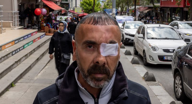 Hakan Yaman poses for a picture at the street where he was wounded during Gezi Park protests in Istanbul