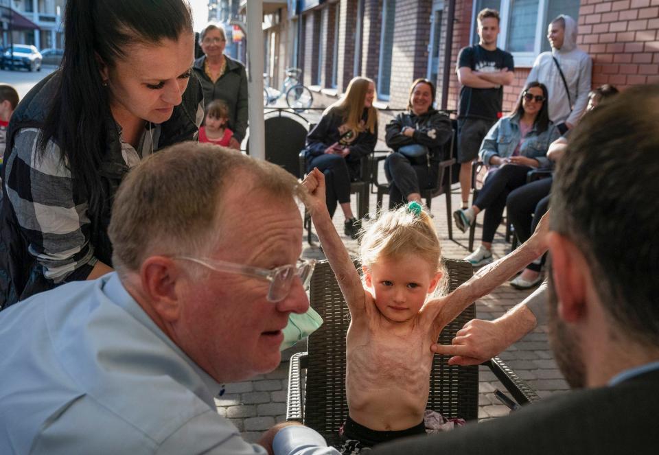 Ludmila Nativa, 31, of Mykolaiv, Ukraine looks on from left as her niece Yelizaveta Nadolniak, 4, is screened by Dr. David Brown, a plastic surgeon from the University of Michigan, lower left, and Dr. Brian Kelley, a plastic surgeon at the University of Texas at Austin Dell Medical School Sunday, May 14, 2023 at a hotel in Leczna, Poland. Nadolniak was burned in a house fire in the winter of 2022 and needs surgery on her scar tissue to be able to move her arms.
(Photo: Mandi Wright, Detroit Free Press)