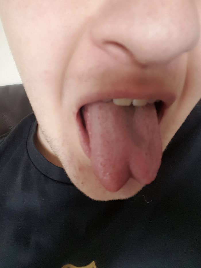 Close-up of a person with their tongue sticking out. No other details are present, and the person's identity is not clear