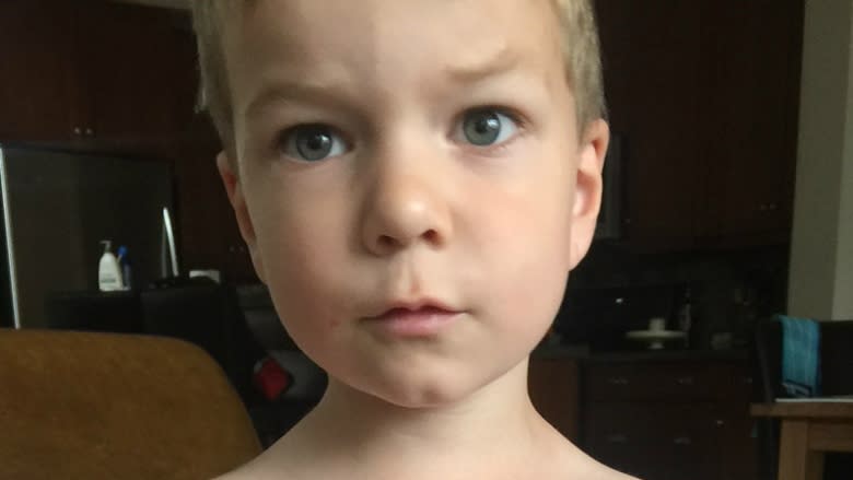 Calgary boy seriously burned by hot Tim Hortons tea has father looking for answers