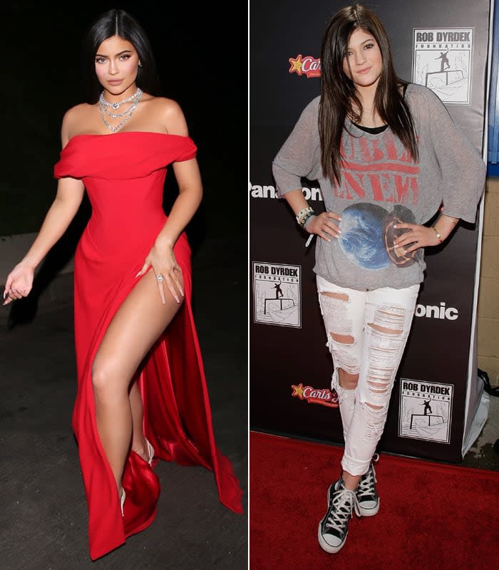 Kylie Jenner reconoce que se ha hecho algunos retoques