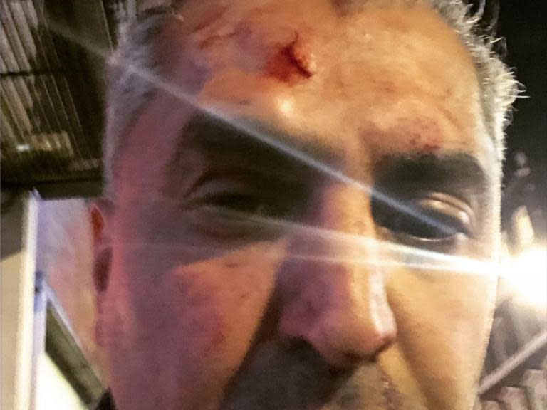 Maajid Nawaz: LBC radio presenter injured in ‘racially motivated’ attack