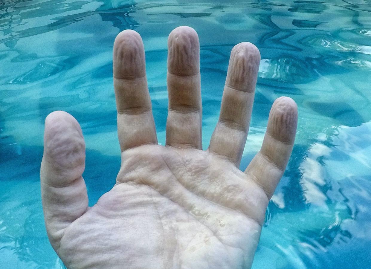 Those puckered prints show up after a while in the water. <a href="https://www.gettyimages.com/detail/photo/human-hand-wrinkled-and-shriveled-due-to-the-long-royalty-free-image/1010765076?adppopup=true" rel="nofollow noopener" target="_blank" data-ylk="slk:MarijaRadovic/iStock via Getty Images;elm:context_link;itc:0;sec:content-canvas" class="link ">MarijaRadovic/iStock via Getty Images</a>