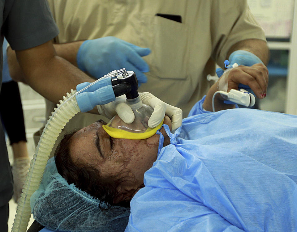 In this Tuesday, Nov. 6, 2018 photo, Saja Ahmed Saleem, is seen in the operating room for her reconstructive surgery, in Baghdad, Iraq. Those whom treatment not available at state-run hospitals and can’t afford treatment at private clinics rely on social media to make appeals that grab attention of some surgeons to help them regain a chance at life. (AP Photo/Hadi Mizban)