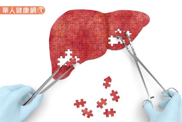 台中慈濟醫院一般外科主任余政展提醒，B、C肝帶原病人一定要接受治療並定期追蹤檢查。