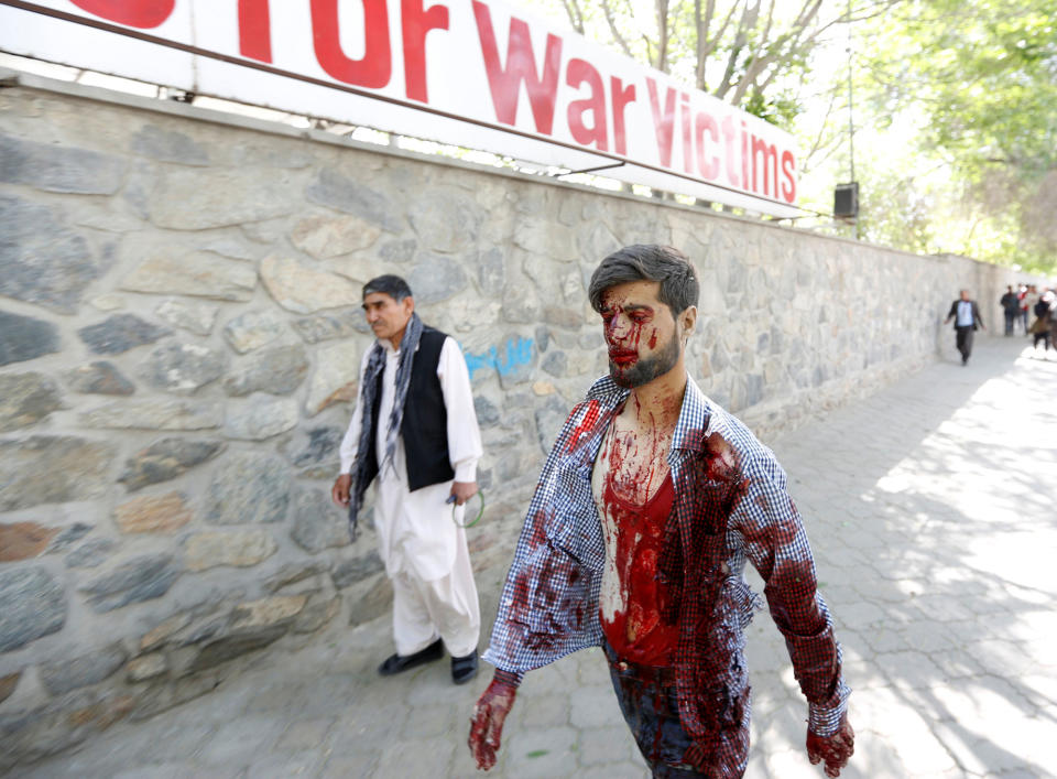 <p>An injured man arrives at a hospital after a blast in Kabul, Afghanistan May 31, 2017. (Mohammad Ismail/Reuters) </p>