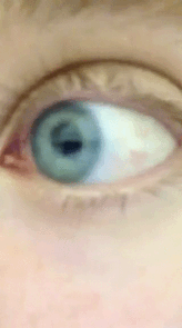 Close-up of a person's eye blinking rapidly and looking from side to side