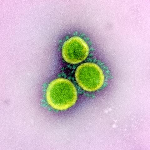 A color-enhance image of SARS-CoV-2 coronavirus isolated from a patient.