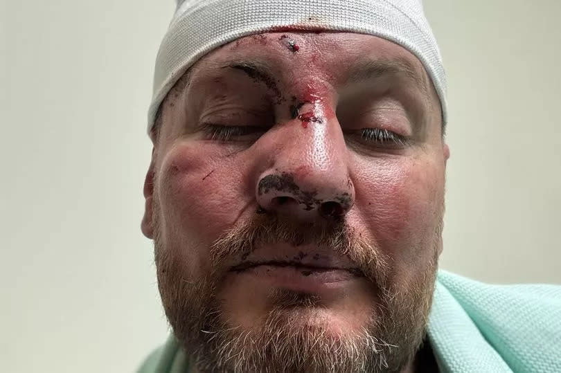A man with injuries in hospital