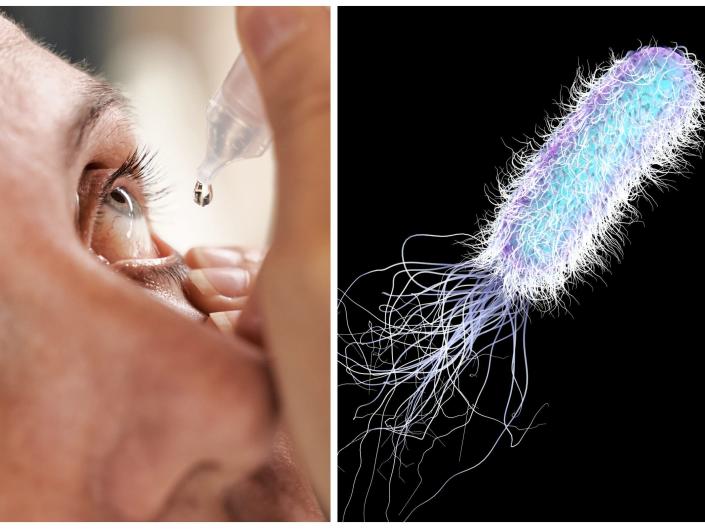 A split image of someone putting in eyedrops and a bacteria.