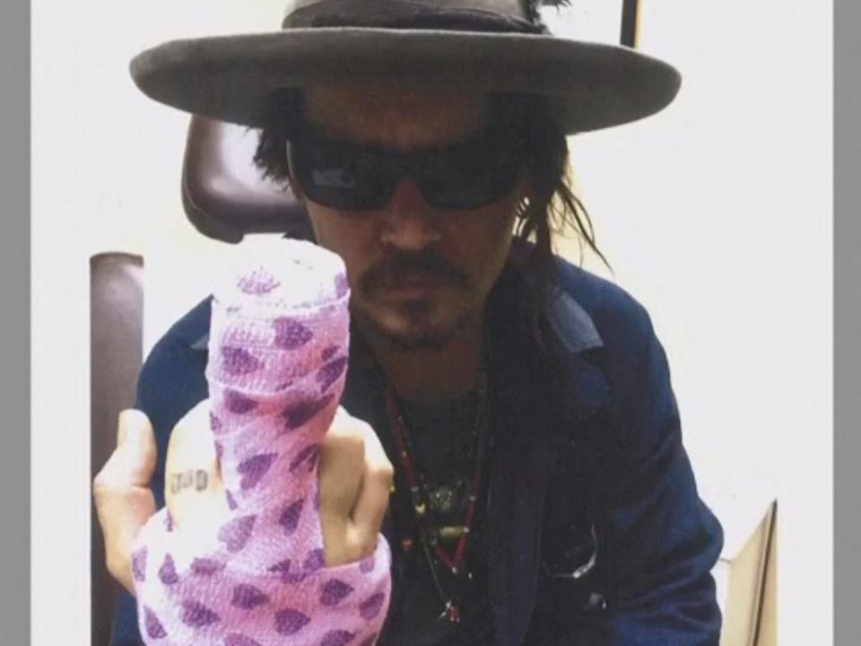 johnny depp finger amber heard trial bandages