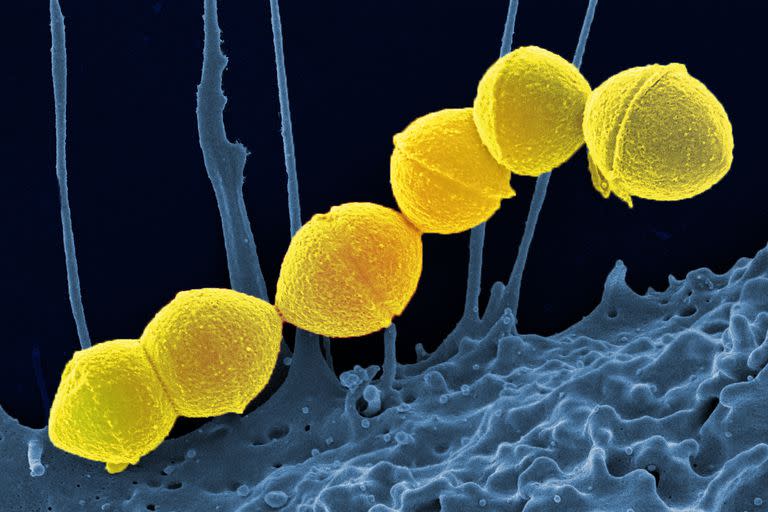 Según precisó el Ministerio de Salud de la Nación, el Streptococcus pyogenes es una bacteria de las cuales existen unos 80 serotipos diferentes