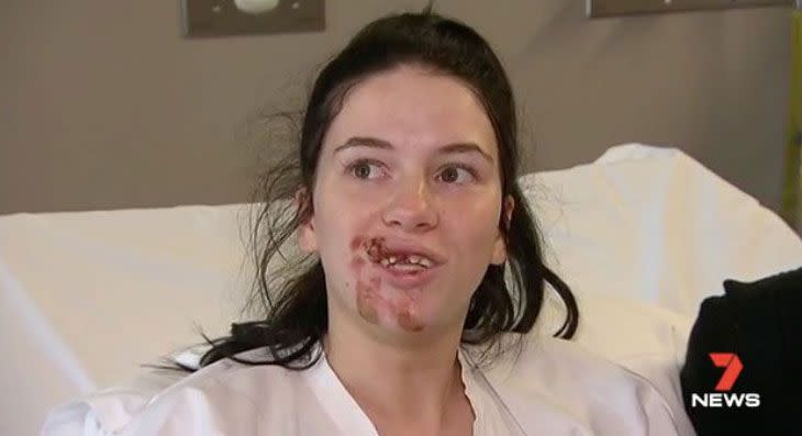 Taylor Hall was dragged 30 metres along the bitumen and will require plastic surgery for her injuries. Source: 7 News