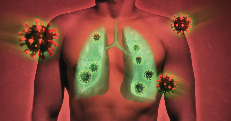 illustrative image of lung damage by coronavirus covid-19. Human anatomy. Concept