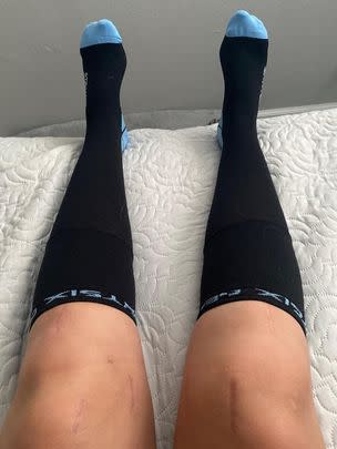 A pair of compression socks