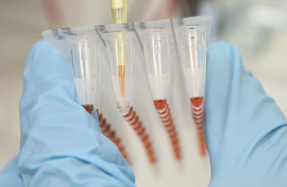 Person pipetting fluid into test tubes with samples, held in a laboratory