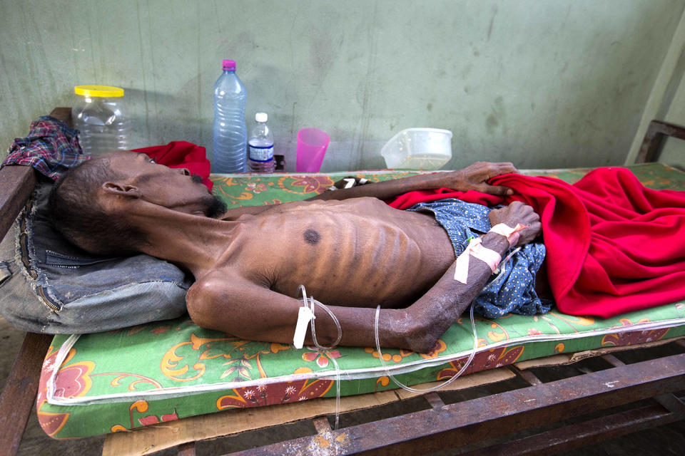 <p>A prisoner, too weak to stand, lies in the prison infirmary at the National Penitentiary in downtown Port-au-Prince, Haiti, Feb. 13, 2017. Haitian prosecutors and rights activists are sounding an alarm about collapsing conditions at the impoverished country’s prisons as malnutrition from acute food shortages and a slew of preventable illnesses are leading to an upsurge of inmate deaths. (Photo: Dieu Nalio Chery/AP) </p>