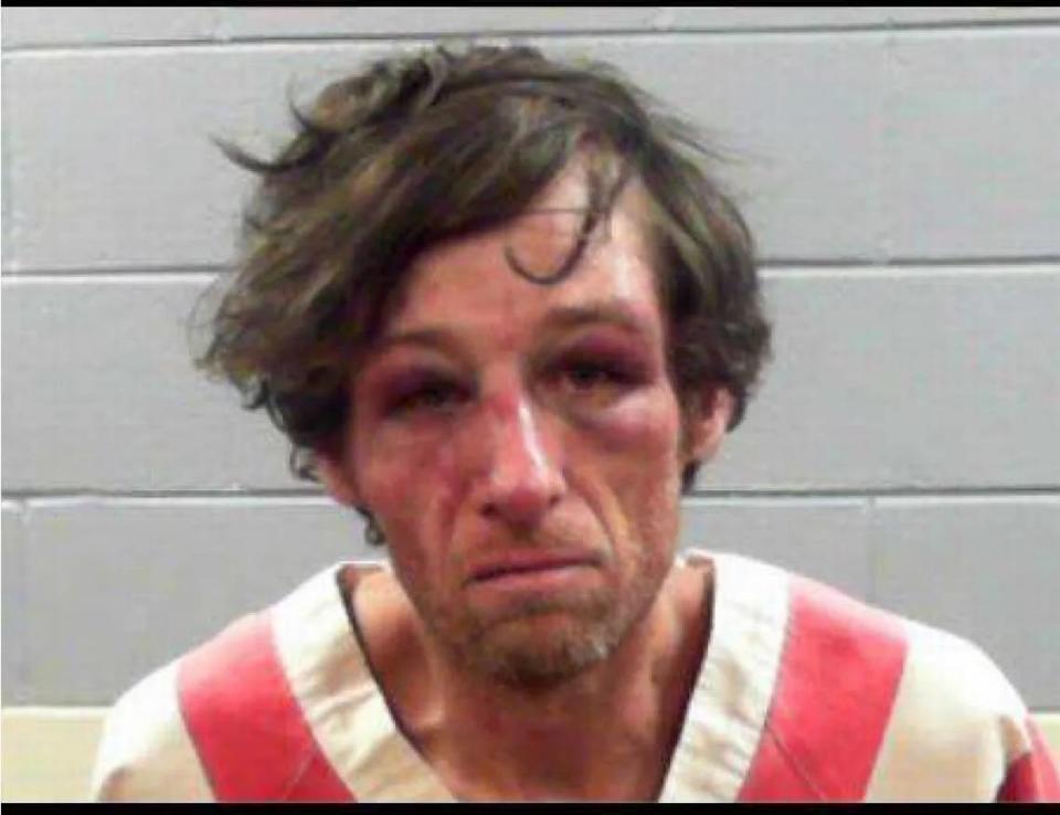 Jeremy Travis Paige’s booking photo, taken at the Rankin County jail in 2018, shows his battered and bruised face after an encounter with deputies.