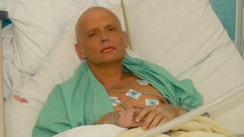 Alexander Litvinenko fotografiado en la UCI del University College Hospital de Londres, el 20 de noviembre de 2006