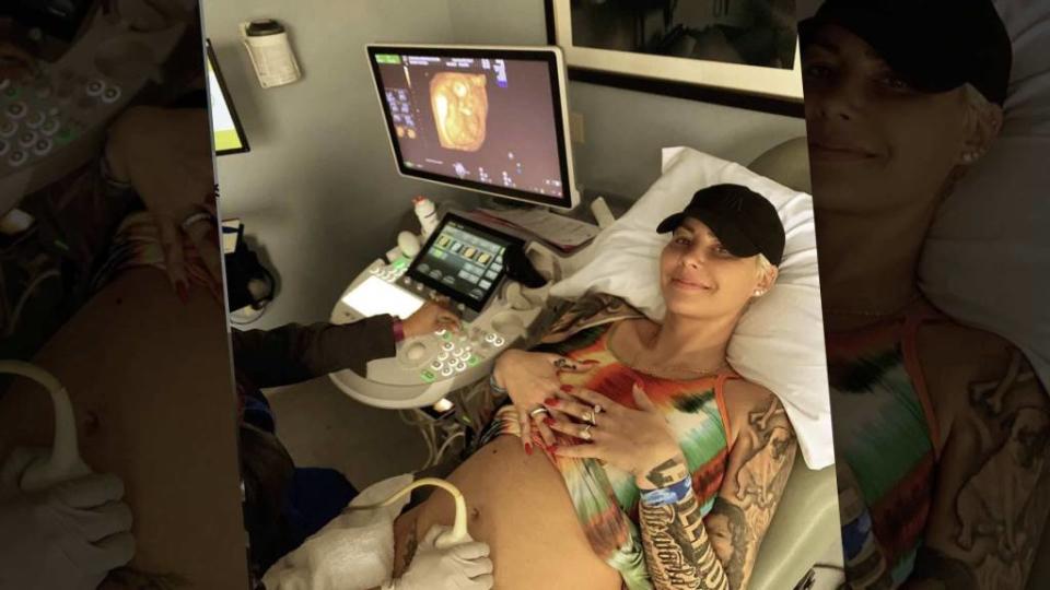<p>Muva is pregnant with baby #2! Amber Rose announced she’s expecting a son with boyfriend Alexander “AE” Edwards on Wednesday. Sharing a photo while getting an ultrasound, she revealed her baby bump. “@ae4president and I are SUPER excited to announce that we have a Sweet little Baby Boy on the way!” Amber wrote. As expected, […]</p> <p>The post <a rel="nofollow noopener" href="https://theblast.com/amber-rose-pregnant-alexander-edwards/" target="_blank" data-ylk="slk:Amber Rose Just Announced She’s Pregnant With a Baby Boy;elm:context_link;itc:0;sec:content-canvas" class="link ">Amber Rose Just Announced She’s Pregnant With a Baby Boy</a> appeared first on <a rel="nofollow noopener" href="https://theblast.com" target="_blank" data-ylk="slk:The Blast;elm:context_link;itc:0;sec:content-canvas" class="link ">The Blast</a>.</p>