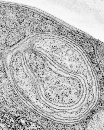 This microscopy image shows an endoplasmic reticulum engulfed by an autophagosome. <a href="https://doi.org/10.1371/journal.pbio.0040442.g001" rel="nofollow noopener" target="_blank" data-ylk="slk:Liza Gross/PLoS Biology;elm:context_link;itc:0;sec:content-canvas" class="link ">Liza Gross/PLoS Biology</a>, <a href="http://creativecommons.org/licenses/by-sa/4.0/" rel="nofollow noopener" target="_blank" data-ylk="slk:CC BY-SA;elm:context_link;itc:0;sec:content-canvas" class="link ">CC BY-SA</a>