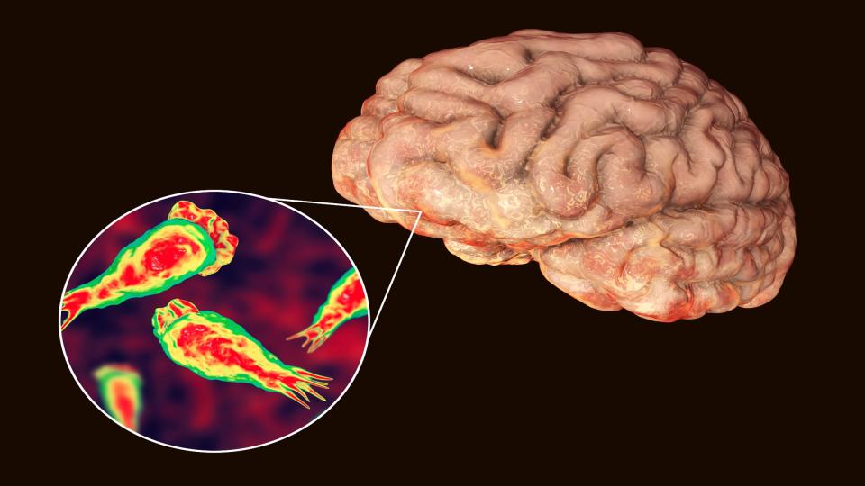 Illustration of the brain with a pop-out close up of brain-eating amoeba