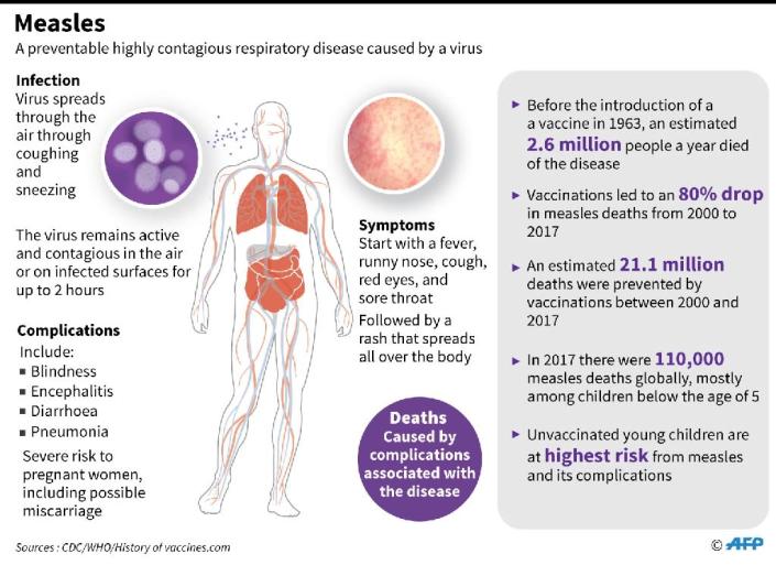 Factfile on measles. (AFP Photo/)