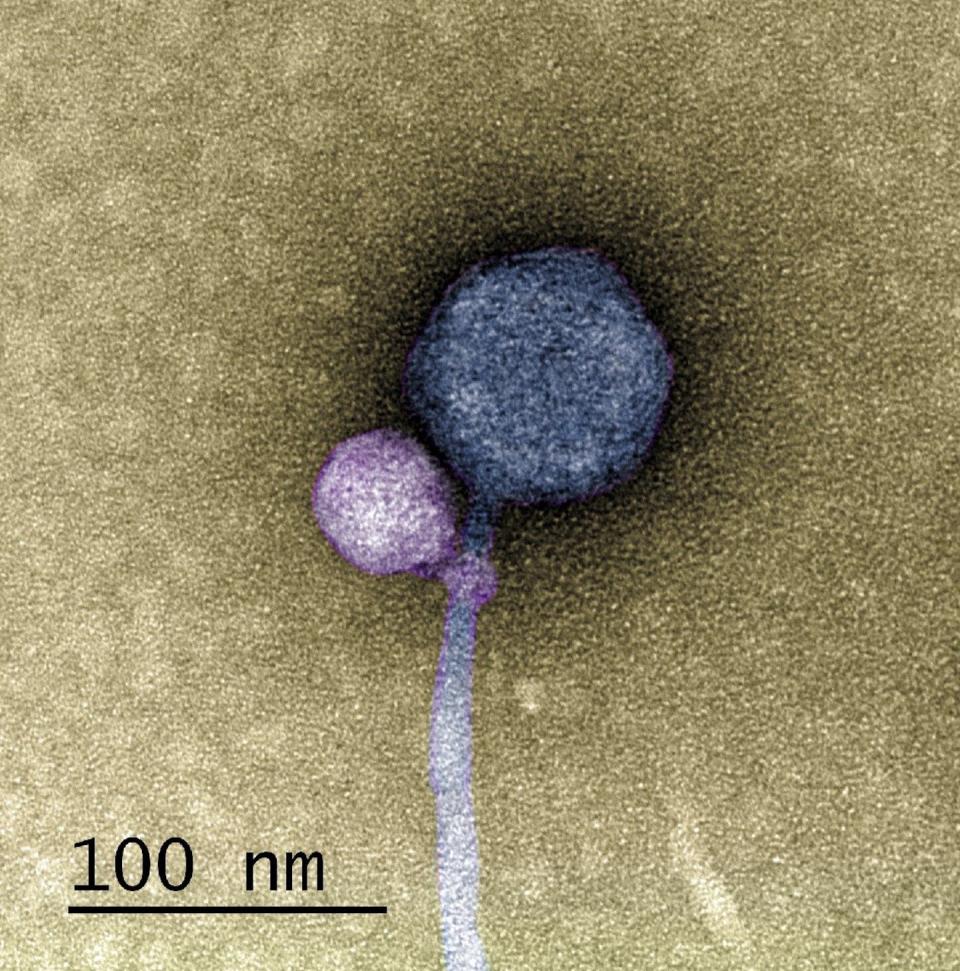 This image shows <em>Streptomyces</em> satellite phage MiniFlayer (purple) attached to the neck of its helper virus, <em>Streptomyces</em> phage MindFlayer (gray). <a href="https://doi.org/10.1038/s41396-023-01548-0" rel="nofollow noopener" target="_blank" data-ylk="slk:Tagide deCarvalho;elm:context_link;itc:0;sec:content-canvas" class="link ">Tagide deCarvalho</a>, <a href="http://creativecommons.org/licenses/by-sa/4.0/" rel="nofollow noopener" target="_blank" data-ylk="slk:CC BY-SA;elm:context_link;itc:0;sec:content-canvas" class="link ">CC BY-SA</a>