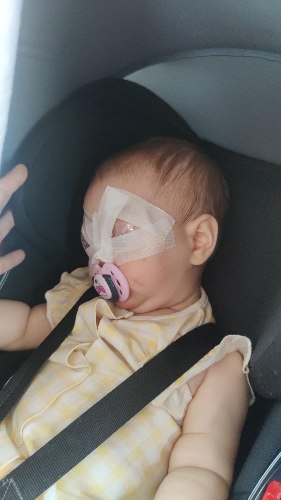 By nine months old Aretria had already undergone two rounds of surgery on her eyes. (SWNS)