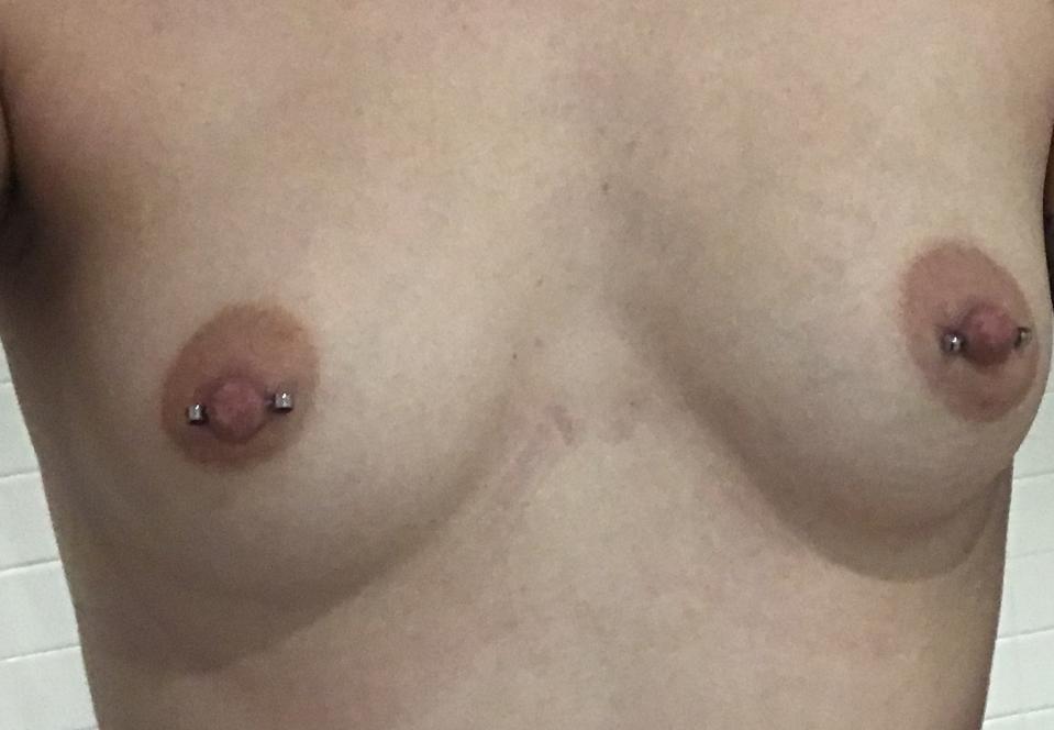 We spoke with professional piercers and a dermatologist to find what you need to know about nipple piercings, then asked four women what it was like to get theirs. Read about their experiences and watch the video of one woman's piercing here.