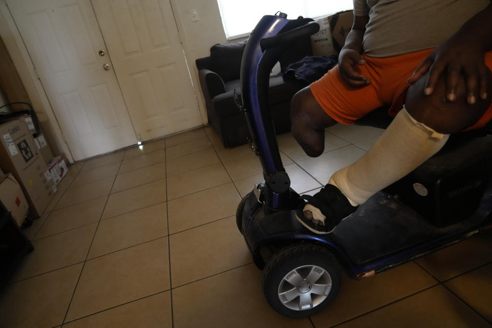 Freddie Davis, who lost a leg to diabetes, suffers from congestive heart failure, and is recovering from multiple wounds on his other leg and foot, surveys his apartment and belongings as he prepares for an eviction that he knows could come at any time, Thursday, Sept. 2, 2021, in Miami. (AP Photo/Rebecca Blackwell)