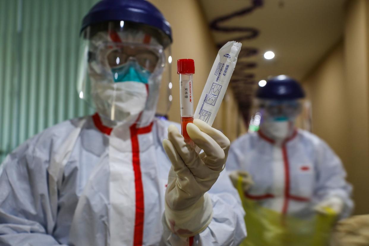 This photo taken on February 4, 2020 shows a medical staff member showing a test tube after taking samples taken from a person to be tested for the new coronavirus at a quarantine zone in Wuhan, the epicentre of the outbreak, in China's central Hubei province. - The world has a "window of opportunity" to halt the spread of a deadly new virus, global health experts said, as the number of people infected in China jumped to 24,000 and millions more were ordered to stay indoors. (Photo by STR / AFP) / China OUT (Photo by STR/AFP via Getty Images)