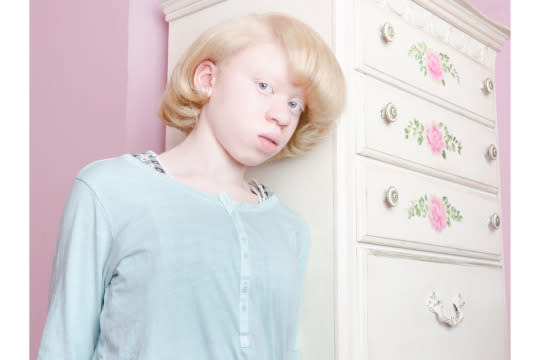 Still, some of them expressed to her the difficulty of dealing with frequent unwanted attention. “One told me, ‘Albinism has really affected my personality. I can’t be who I am, truly, because of how others look at me and how they treat me. I always stick out in a crowd, I’m always noticed, and most of the time the center of attention, and I don’t really want to be.’”
