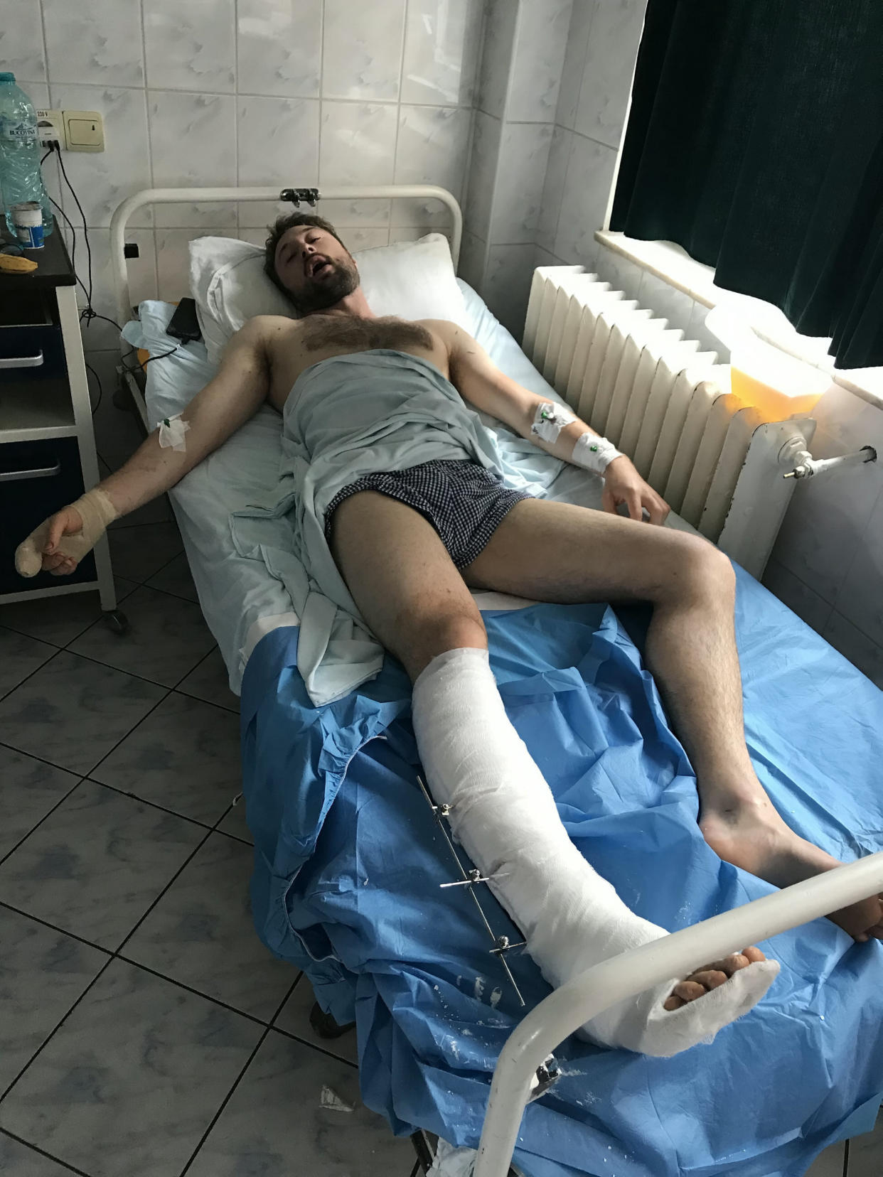 Andi Beauer in a hospital in Romania after being attacked by a bear (Picture: SWNS)