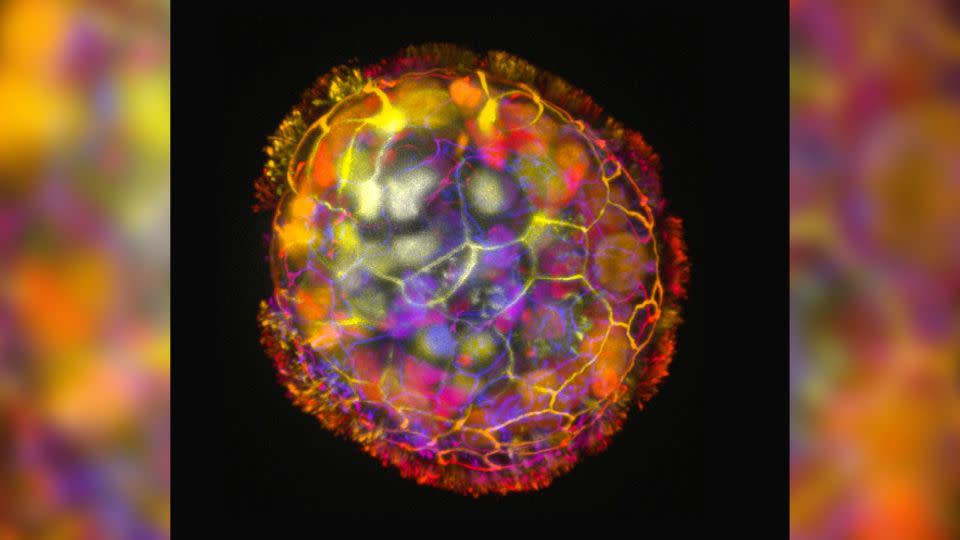 Color image shows the multicellular structure of an anthrobot.  Its surface cilia enable it to move and explore its environment.  - Gizem Gumuskaya Tufts University