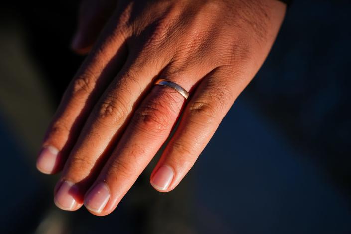 Ahmad Naeem Wakili, shows his wedding ring on Feb. 18, 2022, in Tucson. With the help of Tucson City Council Member Steve Kozachik, Wakili has been trying to relocate his wife and daughter to Tucson from Istanbul, Turkey.