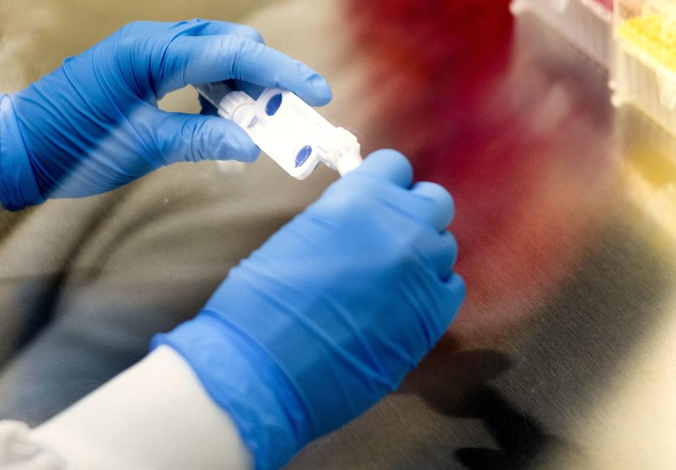 Research scientist Madi Pyper processes tissue samples at Seek Labs in Salt Lake City on Thursday, Nov. 9, 2023. | Laura Seitz, Deseret News