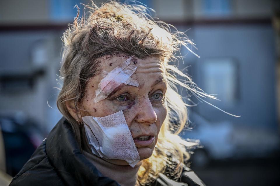 An injured woman, her forehead and jaw bandaged, stands outside a hospital.